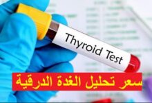 تحليل الغدة الدرقية TSH