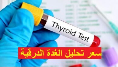 تحليل الغدة الدرقية TSH