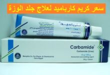 كريم كارباميد لعلاج جلد الوزة