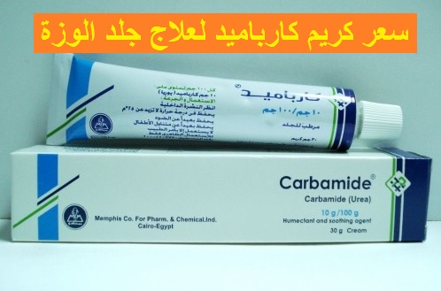 كريم كارباميد لعلاج جلد الوزة